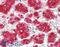 NPC Intracellular Cholesterol Transporter 1 antibody, LS-B6281, Lifespan Biosciences, Immunohistochemistry frozen image 