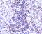 Histone Cluster 1 H2A Family Member E antibody, A16777-1, Boster Biological Technology, Immunohistochemistry paraffin image 