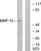 Matrix Metallopeptidase 19 antibody, TA311663, Origene, Western Blot image 