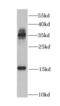 Cystatin SN antibody, FNab02032, FineTest, Western Blot image 