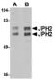 Junctophilin 2 antibody, LS-B3874, Lifespan Biosciences, Western Blot image 