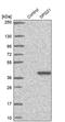 SPG21 Abhydrolase Domain Containing, Maspardin antibody, PA5-59176, Invitrogen Antibodies, Western Blot image 