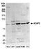 ArfGAP With Coiled-Coil, Ankyrin Repeat And PH Domains 2 antibody, A304-656A, Bethyl Labs, Western Blot image 