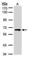Glucosylceramidase Beta antibody, TA308240, Origene, Western Blot image 