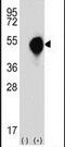 Decapping Exoribonuclease antibody, PA5-13587, Invitrogen Antibodies, Western Blot image 