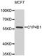 Cytochrome P450 Family 4 Subfamily B Member 1 antibody, STJ28974, St John