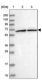 SUMO Interacting Motifs Containing 1 antibody, PA5-58153, Invitrogen Antibodies, Western Blot image 