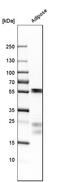 Myocilin antibody, HPA027364, Atlas Antibodies, Western Blot image 