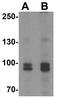 Fibroblast Growth Factor Receptor 3 antibody, GTX31549, GeneTex, Western Blot image 
