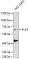 Plasminogen Activator, Tissue Type antibody, GTX32930, GeneTex, Western Blot image 