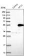 Metaxin 1 antibody, NBP1-87741, Novus Biologicals, Western Blot image 