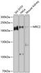 UPARAP antibody, GTX66584, GeneTex, Western Blot image 