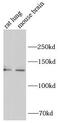 Solute carrier family 12 member 2 antibody, FNab07906, FineTest, Immunohistochemistry paraffin image 