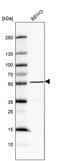 Matrix Remodeling Associated 8 antibody, PA5-63178, Invitrogen Antibodies, Western Blot image 