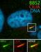 Bardet-Biedl Syndrome 2 antibody, 11188-2-AP, Proteintech Group, Immunofluorescence image 