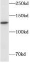 hSIRT1 antibody, FNab07878, FineTest, Western Blot image 