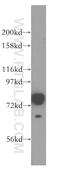 Acyl-CoA Synthetase Long Chain Family Member 1 antibody, 13989-1-AP, Proteintech Group, Western Blot image 