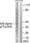 NF-kappa-B inhibitor alpha antibody, TA312677, Origene, Western Blot image 