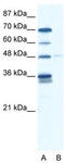 Zinc finger protein GLIS2 antibody, TA329653, Origene, Western Blot image 