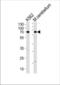 EPM2A-interacting protein 1 antibody, TA328142, Origene, Western Blot image 
