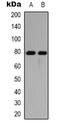 Microtubule Associated Protein Tau antibody, orb338916, Biorbyt, Western Blot image 
