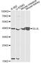 Glutamate-Ammonia Ligase antibody, STJ27390, St John