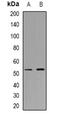 Carbohydrate Sulfotransferase 9 antibody, orb382475, Biorbyt, Western Blot image 