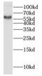 Hyaluronidase-2 antibody, FNab04087, FineTest, Western Blot image 