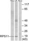 Ribosomal Protein S11 antibody, TA314488, Origene, Western Blot image 