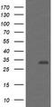 Proteasome Inhibitor Subunit 1 antibody, TA505275, Origene, Western Blot image 