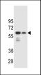 Carbohydrate Sulfotransferase 3 antibody, LS-C168763, Lifespan Biosciences, Western Blot image 