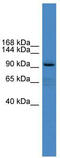 Xylosyltransferase 1 antibody, TA338489, Origene, Western Blot image 