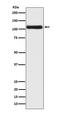 Androgen Receptor antibody, M00542-2, Boster Biological Technology, Western Blot image 