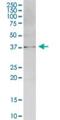 Carnosine Synthase 1 antibody, H00057571-B01P, Novus Biologicals, Western Blot image 