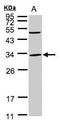 Penta-EF-Hand Domain Containing 1 antibody, TA307980, Origene, Western Blot image 