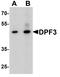 Zinc finger protein DPF3 antibody, LS-C201152, Lifespan Biosciences, Western Blot image 