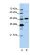 Nucleolar Protein 4 antibody, NBP1-57244, Novus Biologicals, Western Blot image 
