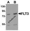 Fms Related Tyrosine Kinase 3 antibody, 7027, ProSci, Western Blot image 