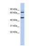 Zinc Finger And BTB Domain Containing 26 antibody, NBP1-80350, Novus Biologicals, Western Blot image 