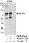 Pre-MRNA Processing Factor 3 antibody, A302-074A, Bethyl Labs, Immunoprecipitation image 