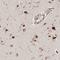 Sushi Domain Containing 6 antibody, HPA030464, Atlas Antibodies, Immunohistochemistry paraffin image 