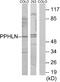 Periphilin 1 antibody, A30527, Boster Biological Technology, Western Blot image 