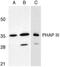 Acidic Nuclear Phosphoprotein 32 Family Member E antibody, PA1-30729, Invitrogen Antibodies, Western Blot image 
