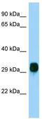 F-Box Protein 17 antibody, TA331636, Origene, Western Blot image 