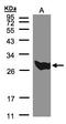 Phosphoglycerate mutase 1 antibody, LS-C185793, Lifespan Biosciences, Western Blot image 