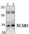 Fibroblast Growth Factor 5 antibody, PA5-75959, Invitrogen Antibodies, Western Blot image 