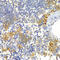 Notch Receptor 1 antibody, A7636, ABclonal Technology, Immunohistochemistry paraffin image 