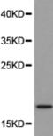 Ribonuclease A Family Member 12 (Inactive) antibody, TA323410, Origene, Western Blot image 