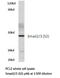 SMAD2 antibody, AP20361PU-N, Origene, Western Blot image 