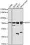 SET Domain Containing 3, Actin Histidine Methyltransferase antibody, A8071, ABclonal Technology, Western Blot image 